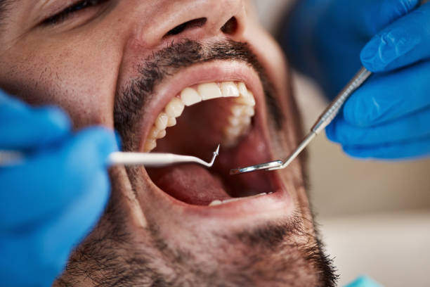 Best Emergency Treatment for Oral Infections in Donna, TX