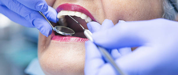 Best Emergency Wisdom Tooth Extraction in Donna, TX